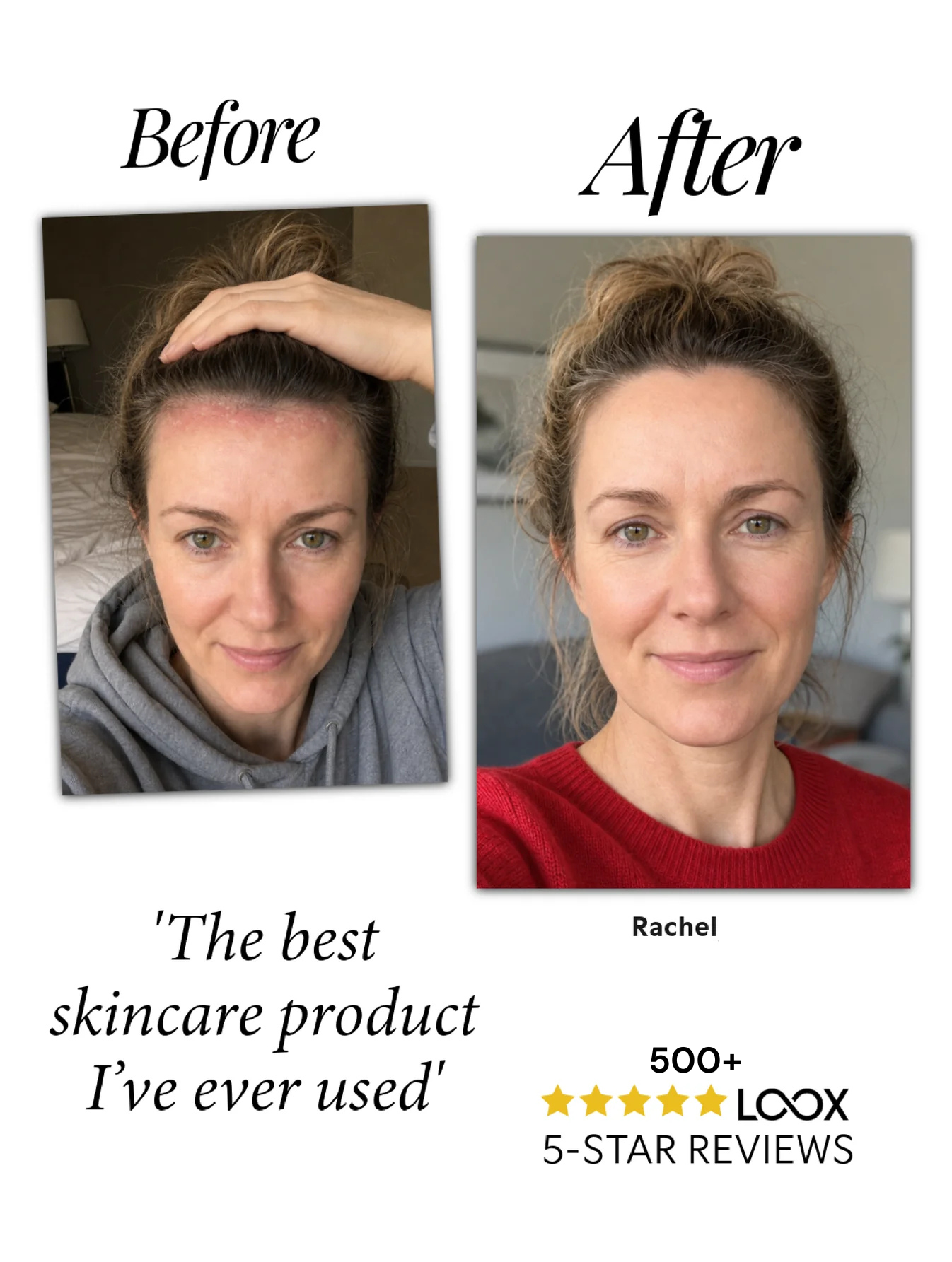 Natural Calming Serum