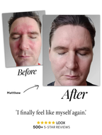 Natural Calming Serum