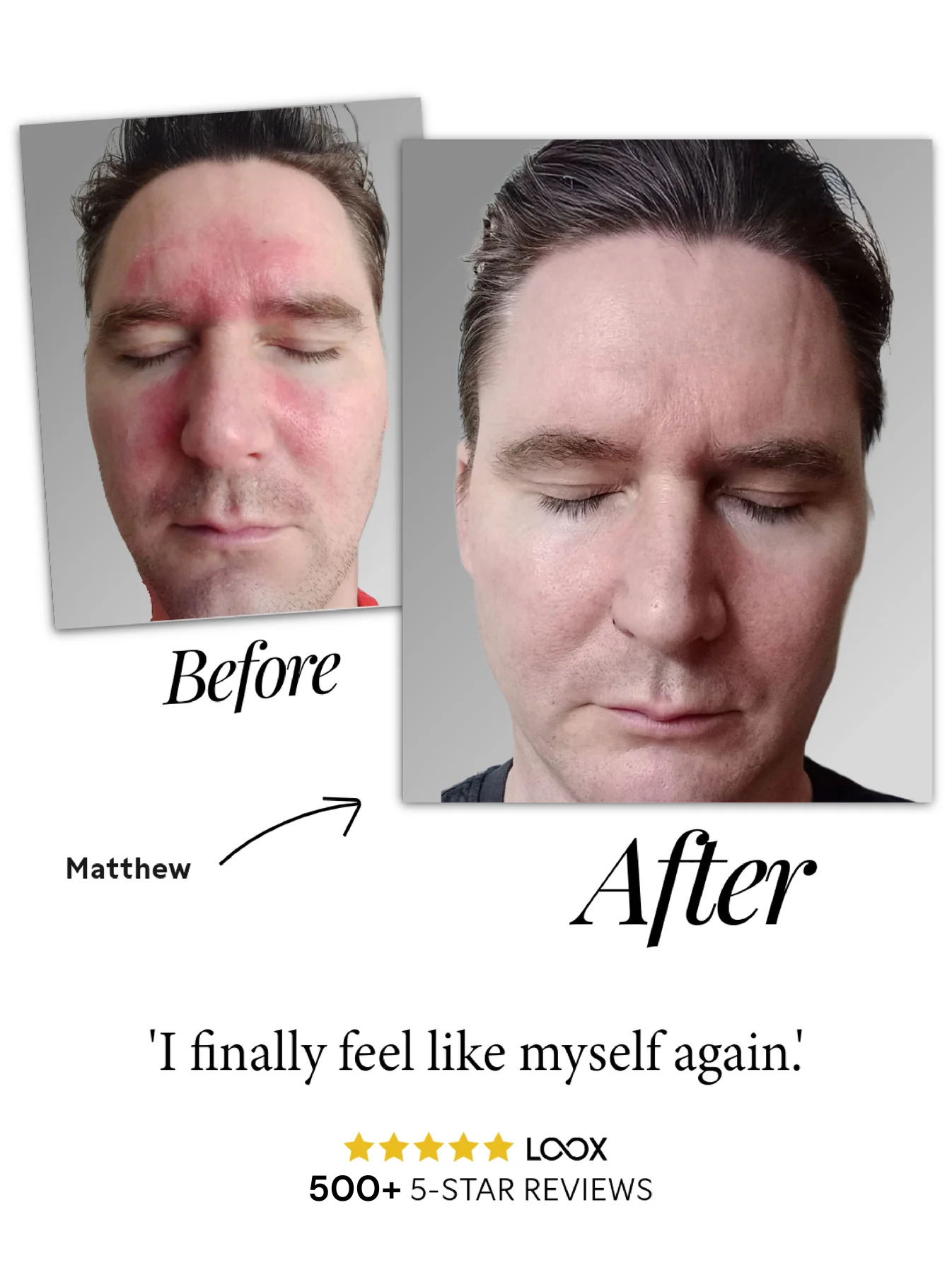 Natural Calming Serum